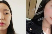 现代整形技术的进展与应用（探索当下整形技术的前沿，解析其在美容与医学领域的应用及挑战）